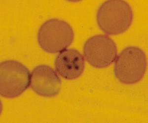 Microfotografia de Babesia en glóbulos rojos