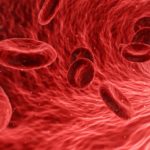 Hemoconcentración: Dícese del aumento de la proporción de hematíe en la sangre, por lo general debido a una reducción del volumen plasmático